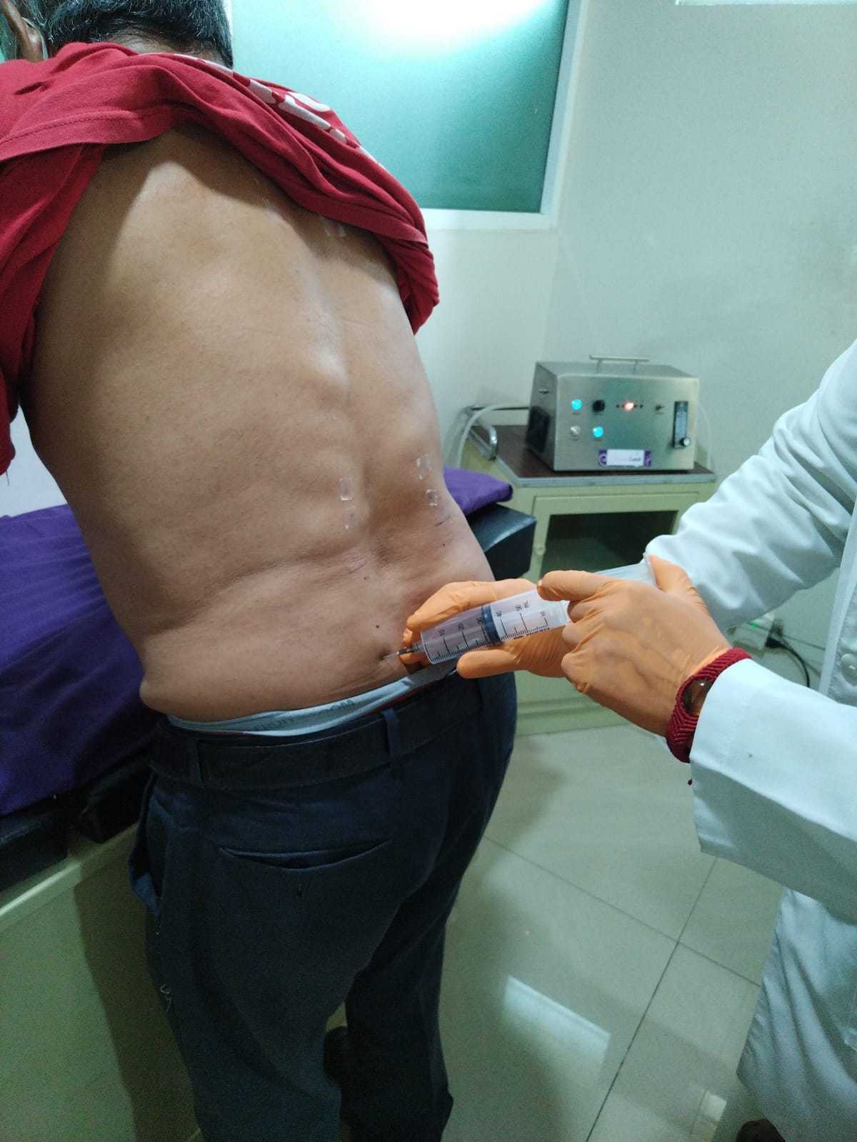 Caso de éxito hernia discal